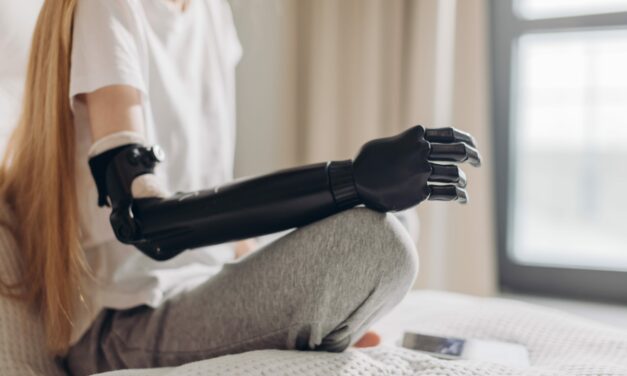 Integrating Smart Technology into Customizable Prosthetics for Oncology Patients