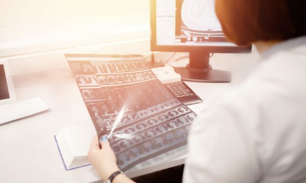 Innovations in Image-Guided Radiotherapy: Maximizing Treatment Precision